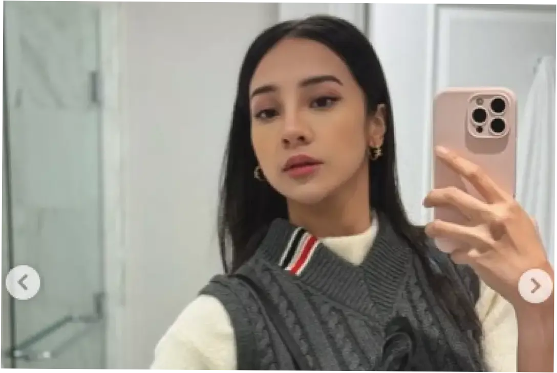 Anya Geraldine Selalu Tampil Sempurna, Atasi Rambut Kering Pakai Masker Minyak Kelapa