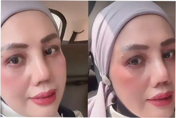 Elly Sugigi Operasi Plastik 4,5 Jam, Malah Ketagihan, Pengin Lagi